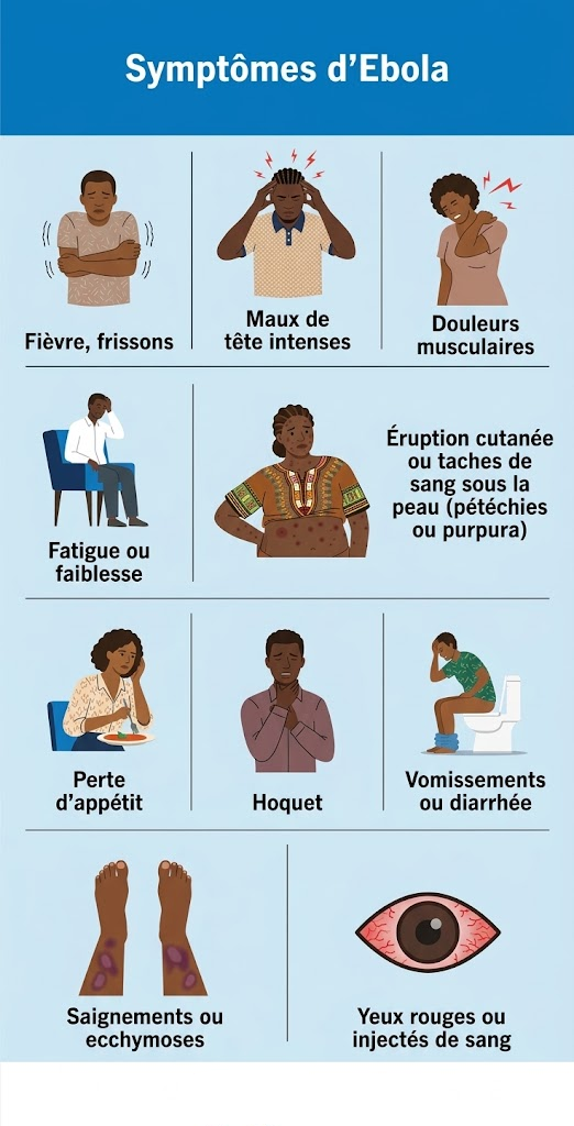 Symptomes ebola